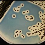 Staphylococcus-aureus counting in food