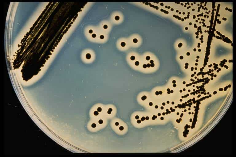 Staphylococcus-aureus counting in food