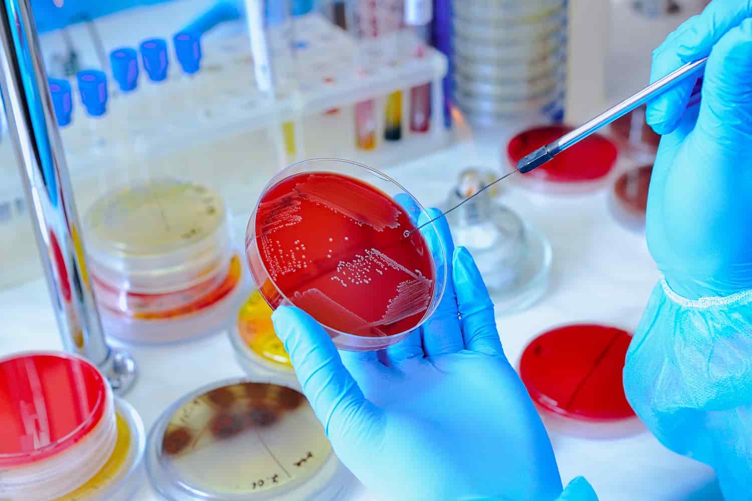 Violet Red Bile Agar (VRB Agar)، محیط کشت vrba(وی آر بی آگار)