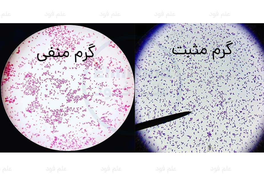 آزمایش رنگ آمیزی گرم مثبت باکتری ها